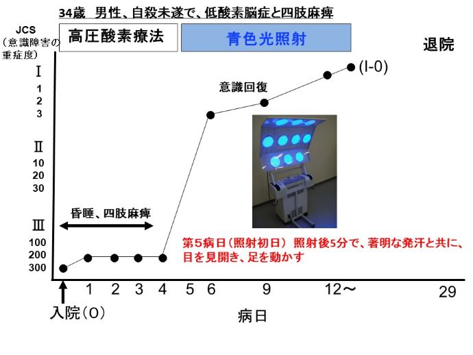 円形脱毛症　病院